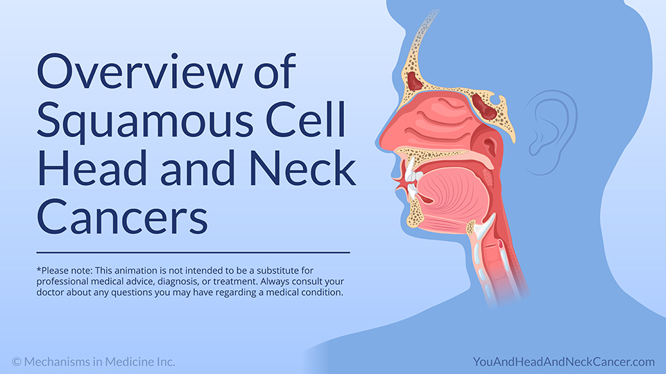 Overview of Squamous Cell Head and Neck Cancers — Animation
